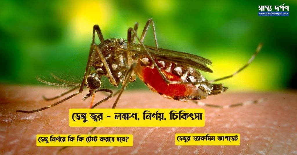 Dengue Fever Explained in Bangla